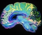 Study provides insight into aging of the brain