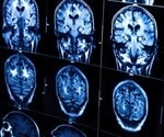 How the brain keeps blood sugar levels in check