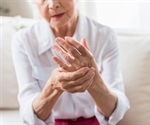 ICI therapy linked to unique immune response in arthritis