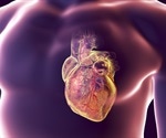 AI model can detect atrial septal defect in ECGs with high accuracy