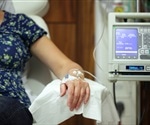 High BMI increases risk of cardiotoxicity in breast cancer patients, study finds