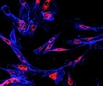 NCI funds study to investigate the underlying cellular mechanisms that drive ER+ breast cancer